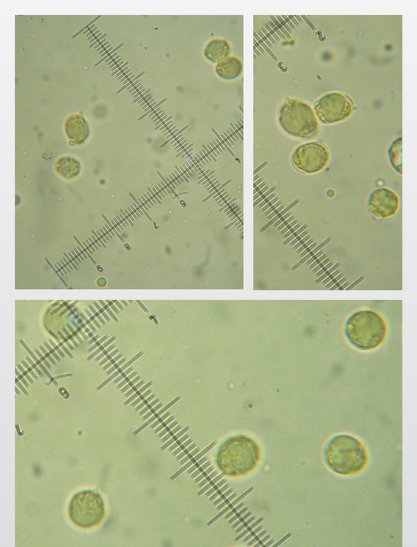 da determinare (Radulomyces confluens)